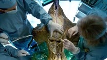 51区科学家解剖外星人，打开胸腔，才发现它的大脑长在内脏里