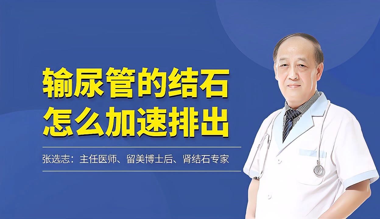 【張選志說結石】輸尿管結石如何加速排出,醫生教你這樣做~-健康視頻